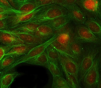 Immunofluorescent staining of FFPE human U-2 OS cells with Retinol Binding Protein 1 antibody (red) 