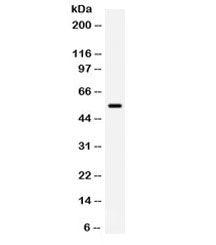 Western blot testing of human placenta lysate with BMPR1B lysate. Predicted/observed molecular weigh