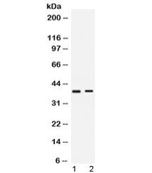 Western blot testing of human 1) HeLa and 2) SW620 cell lysate with HVEM antibody at 0.5ug/ml. Expec