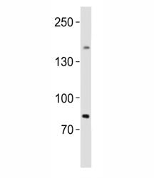 Western blot analysis of lysate from human testis tissue lysate using SALL4 antibody diluted at 1:10