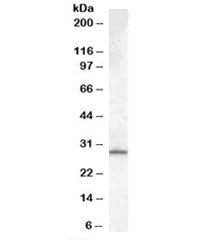 MTHFD2L Antibody