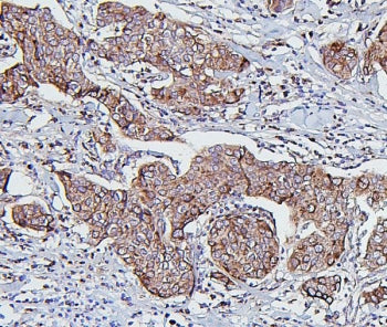HSP60 Antibody