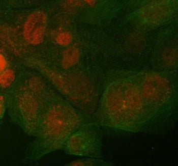 Immunofluorescent staining of FFPE human A431 cells with ST7 antibody (red) and Beta Tubulin mAb (gr