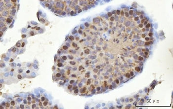IHC staining of FFPE mouse testis tissue with YBX2 antibody. HIER: boil tissue sections in pH8 EDTA 