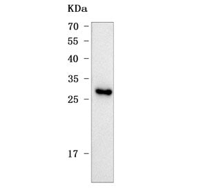 Western blot testing of rat liver tissue lysate with Mis18b antibody. Predicted molecular weight ~25