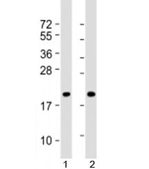 Western blot testing of human 1) NCI-H460 and 2) DU-145 cell lysate with IDNK antibody at 1:8000. Pr