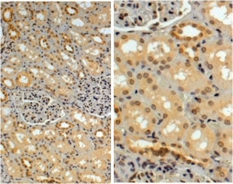 TRIM8 Antibody