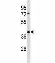 UCHL5 Antibody