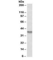Western blot testing of HepG2 lysate with Syndecan 1 antibody at 1ug/ml. Expected molecular weight: 