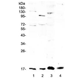 Il1f10 Antibody / Il-38