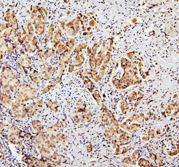 SUZ12 Antibody