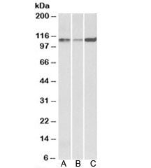 Western blot testing of human [A], mouse [B] and rat [C] heart lysates with SERCA2 antibody at 0.1ug