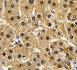 c-Abl Antibody (ABL1)