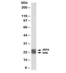 Western blot testing of human spleen lysate with biotinylated Caveolin 1 antibody at 1ug/ml. Alpha a