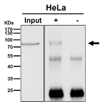 Immunoprecipitation analysis using the antibody at 1:50 dilution. Western blot probed with anti-BRAT