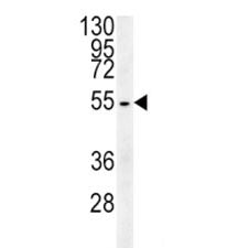 Beta III Tubulin Antibody (TUBB3)