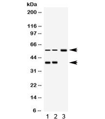 Western blot testing of 1) rat brain, 2) human RH35 and 3) human MCF7 lysate with AHSG antibody. Expected molecular weight ~39 (unmodified), 45-55 kDa (glycosylated).