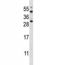 AKT1S1 Antibody