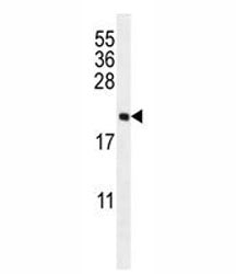 UNQ3104 Antibody