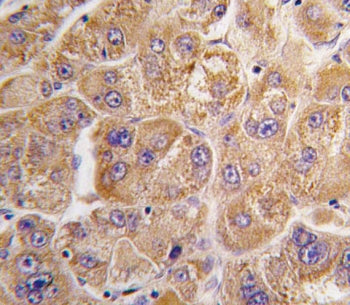 IDE Antibody / Insulin degrading enzyme