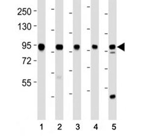EZH2 Antibody