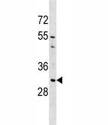 AQP1 Antibody (Aquaporin 1)