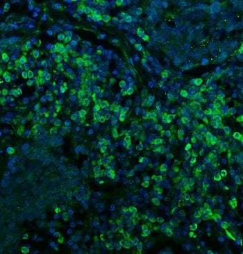 CD74 Antibody