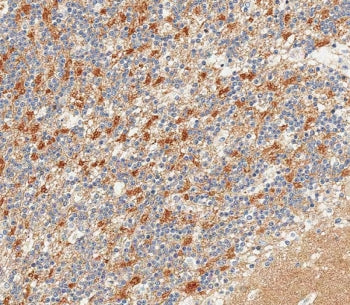 IHC testing of FFPE human cerebellum tissue with Neural cell adhesion molecule 1 antibody. HIER: ste