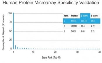 Analysis of HuProt(TM) microarray containing more than 19,000 full-length human proteins using Kerat