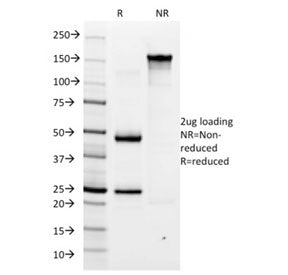 SDS-PAGE analysis of purified, BSA-free Helicobacter pylori antibody (clone HP/1334) as confirmation