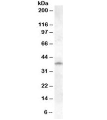 Cathepsin K Antibody