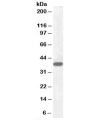 Laforin Antibody