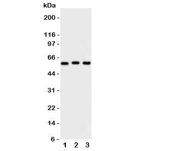 PKM2 Antibody