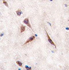 GTPase ERas Antibody / ERAS