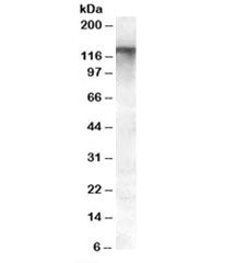 MRP8 Antibody