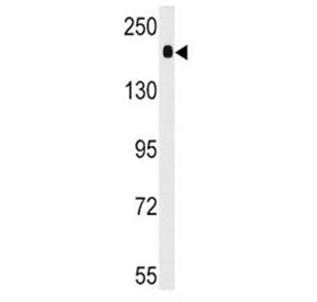 ACE Antibody