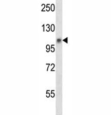 Jak1 Antibody