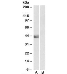 SERPINB1 Antibody