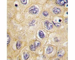 Claudin 1 Antibody