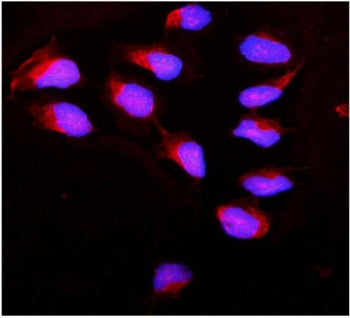 Immunofluorescent staining of FFPE human U-2 OS cells with Calpain antibody (red) and DAPI nuclear s