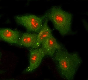 Ribonuclease H1 Antibody / RNASEH1