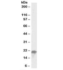 UBE2F Antibody