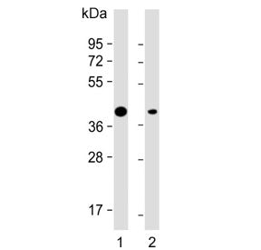 Adiponectin Receptor 2 Antibody / ADIPOR2