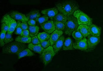 ADORA2B Antibody