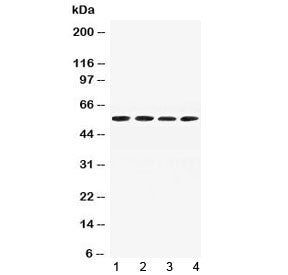 Western blot testing of mouse 1) liver, 2) spleen, 3) testis and 4) kidney lysate with Angiotensinog
