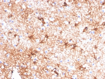 IHC staining of FFPE human cerebellum tissue with Glial Fibrillary Acidic Protein antibody (clone GF