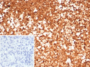 IHC staining of FFPE human spleen tissue with HSP90AA1 antibody (clone HSP90AA1/7426). Inset: PBS us