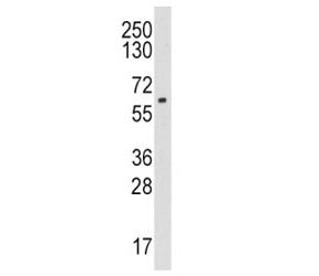 Aromatase Antibody (CYP19A1)