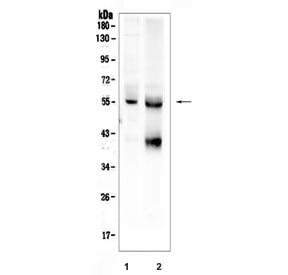 TGFBR1 Antibody / TGF beta Receptor I