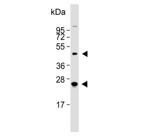 HABP2 Antibody / Hyaluronan-binding protein 2